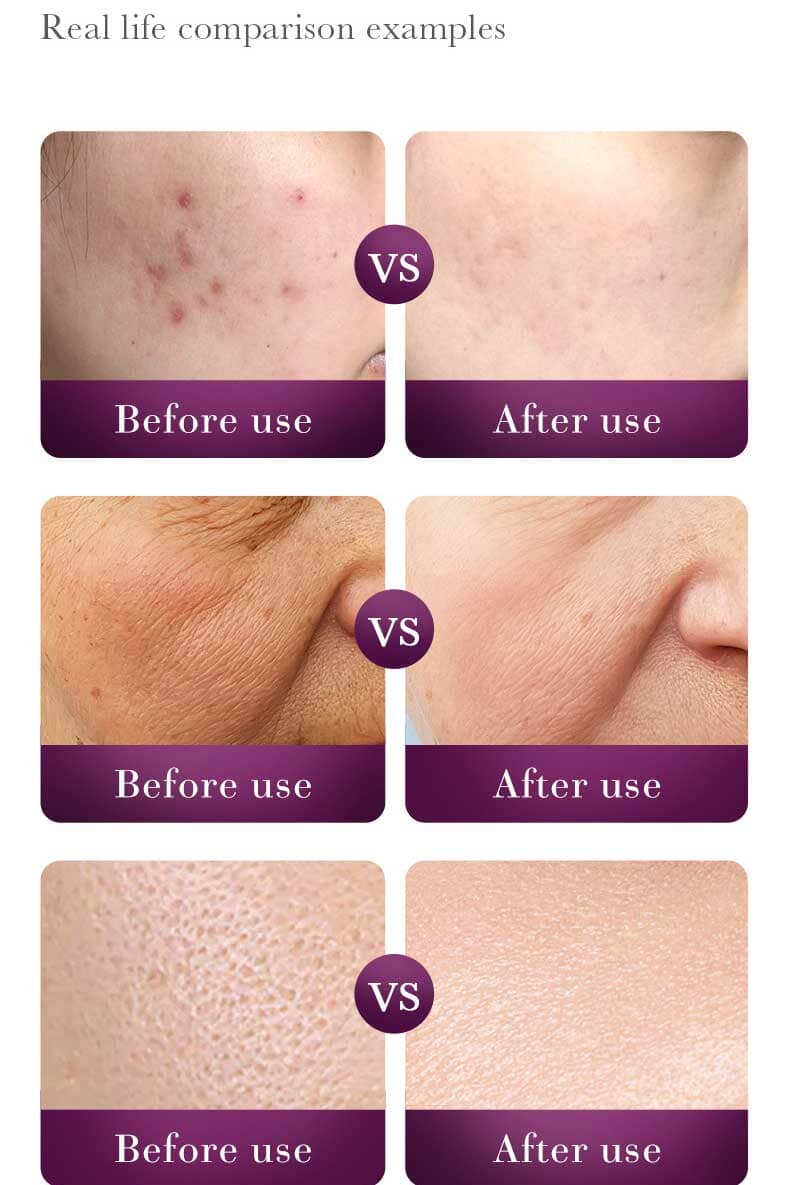 Sadoer Snail Reorganize Collagen Toner - 120ml